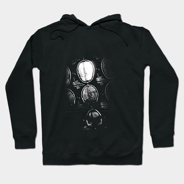 Brain Ray Hoodie by hitext